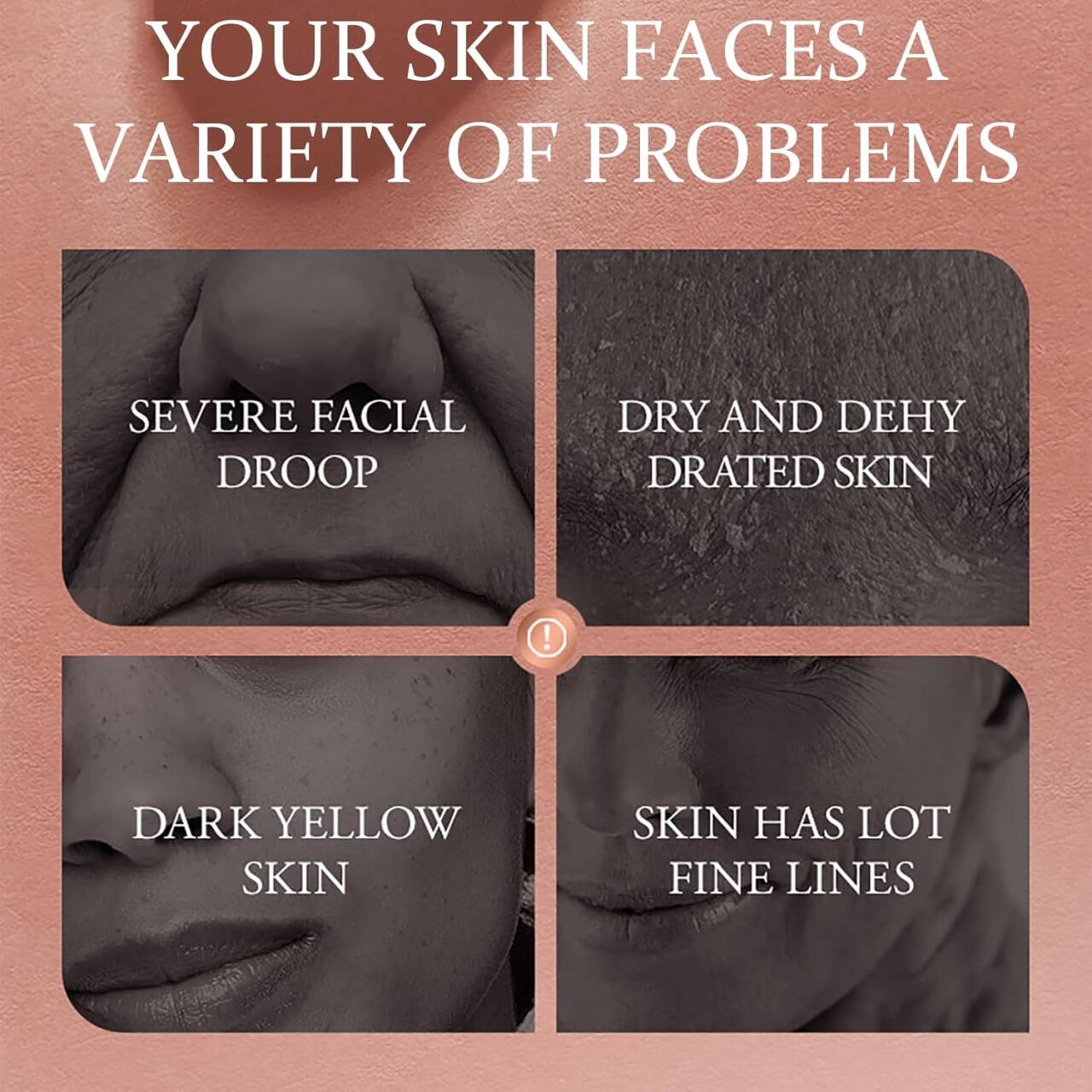 ¡10 Años Menos! Dragon's Blood - Crema Facial Rejuvenecedora