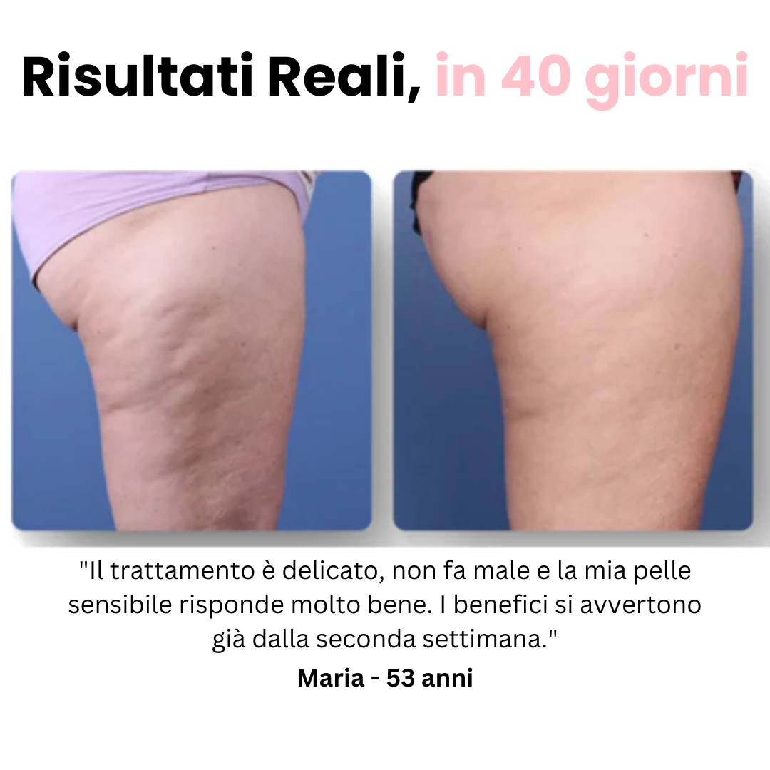 Velora™ - Massaggiatore Anti Cellulite
